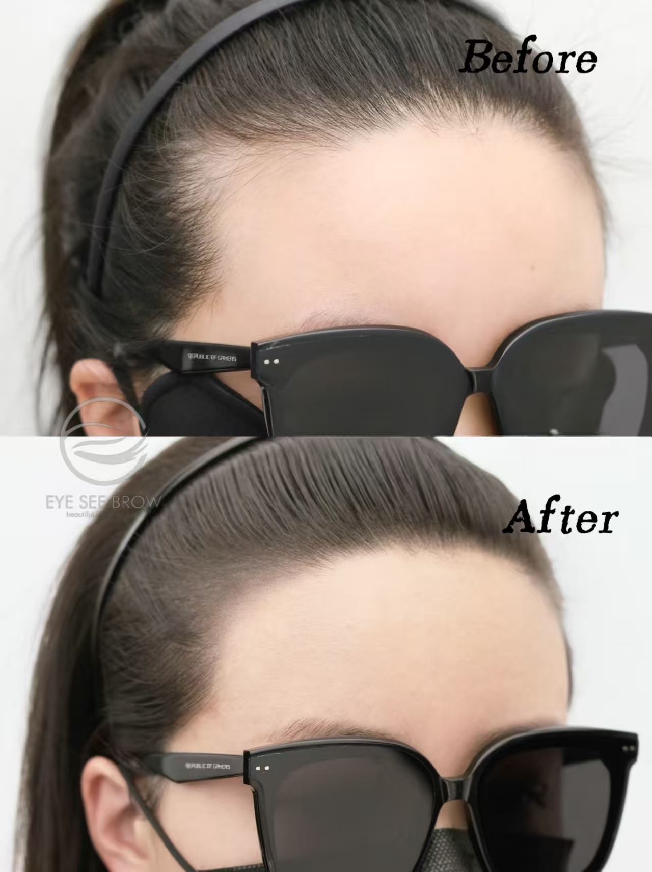 Temple SMP result — 2