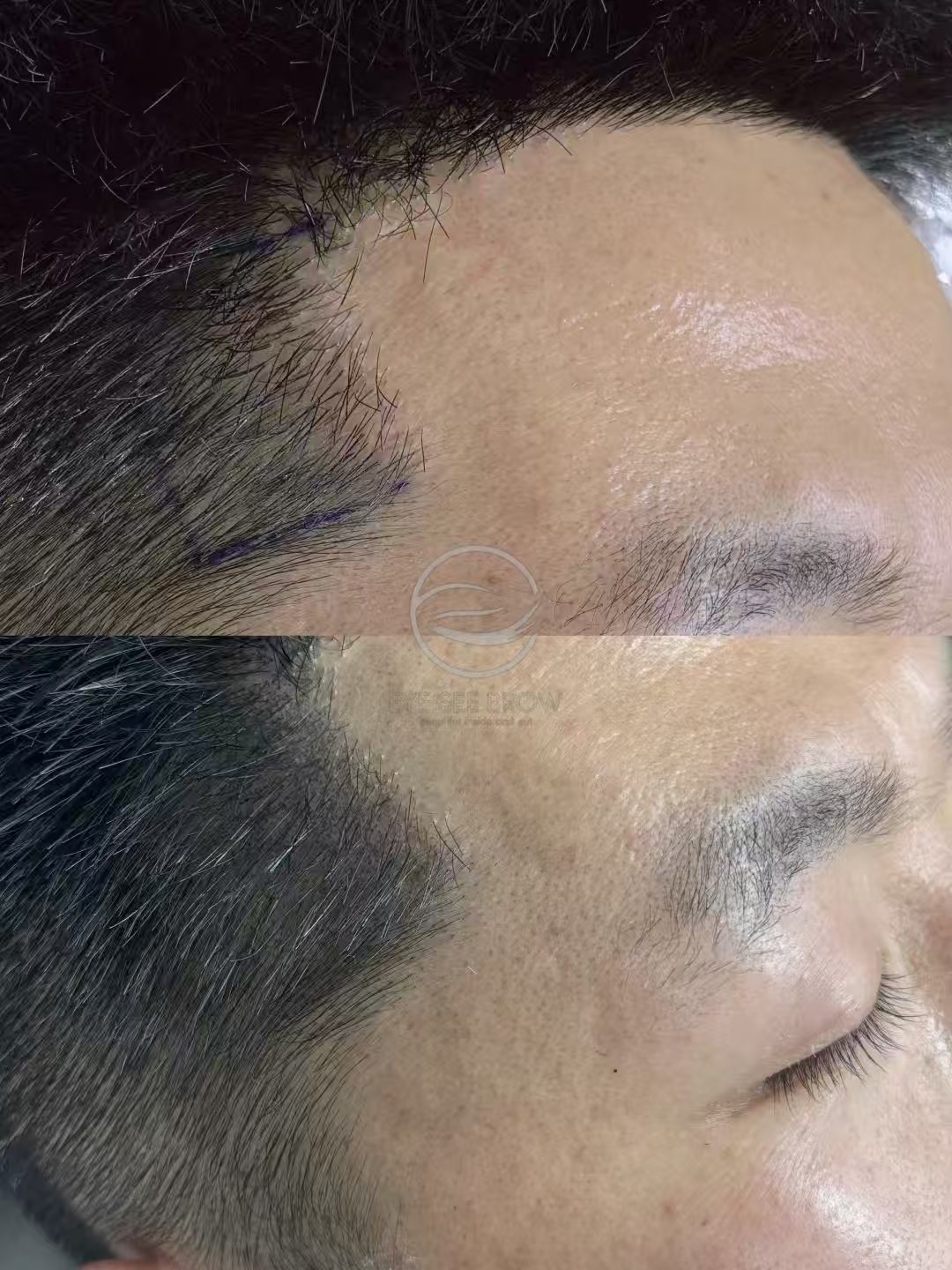 Temple SMP result — 3